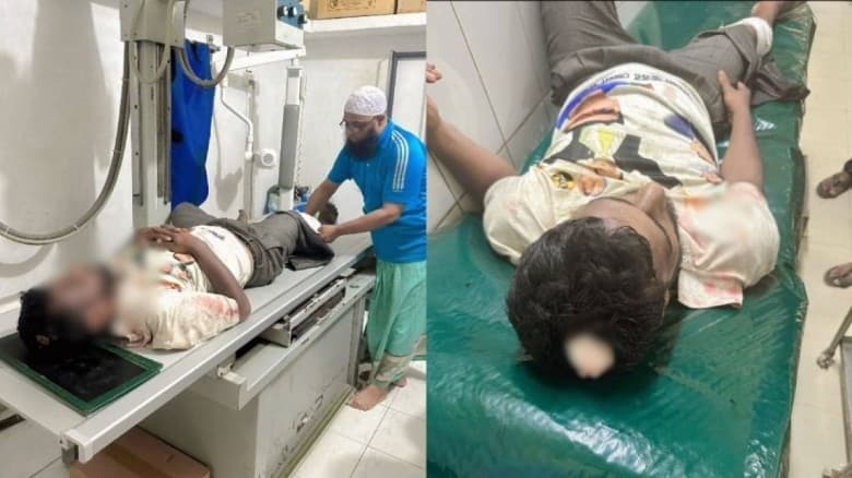 নেতাকে স্বাগত জানাতে গিয়ে বিএনপির দুই গ্রুপের সংঘর্ষ