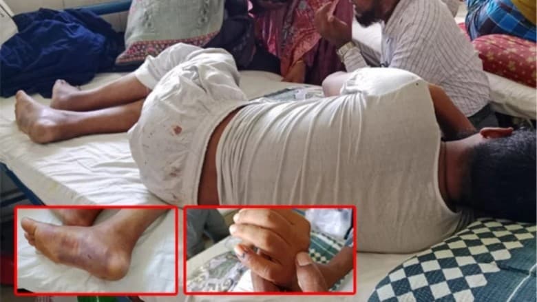 খুলনায় ইসলামী ব্যাংকের ভেতর শিক্ষককে হাতুড়ি ও প্লায়ার্স দিয়ে নির্যাতন