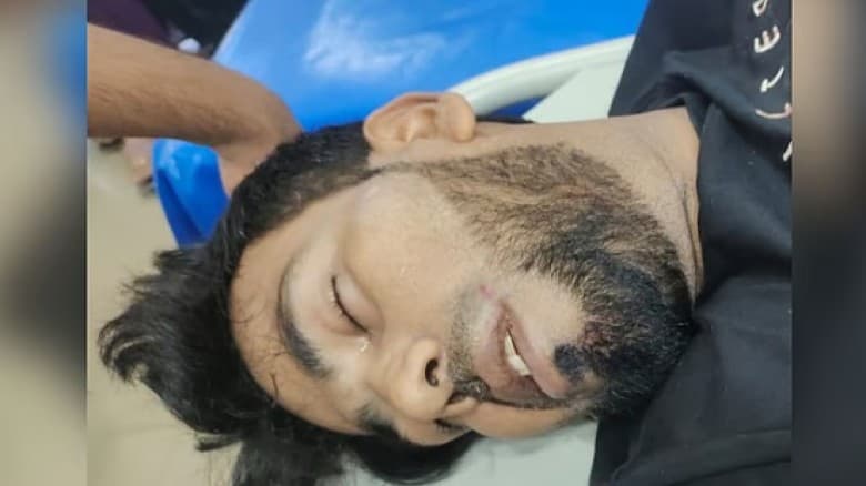 নোয়াখালীতে চাঁদা না পেয়ে প্রবাসীর কবজি কেটে দেওয়ার অভিযোগ
