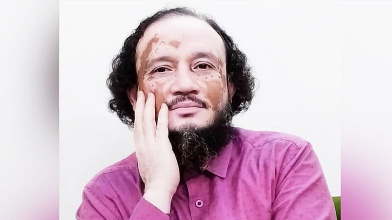 বেরোবিতে নিষিদ্ধ ছাত্রলীগের সুপারিশে নিয়োগপ্রাপ্ত সেই মামদুদুর এখন বিএনপিপন্থী কর্মকর্তা