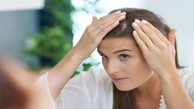 প্রাকৃতিকভাবে শীতের মাথার ত্বক ও চুলের যত্ন
