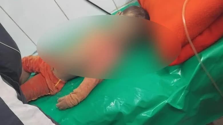 উদ্ধারের পর শিশু সাজিদকে মৃত ঘোষণা