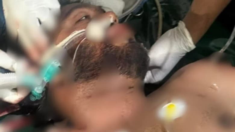 ওসমান হাদির সর্বশেষ অবস্থা জানালেন চিকিৎসক