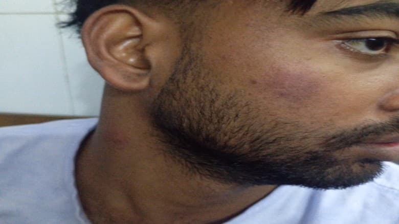 কসবার রামপুরে এক জামায়াত কর্মীর ওপর হামলার অভিযোগ