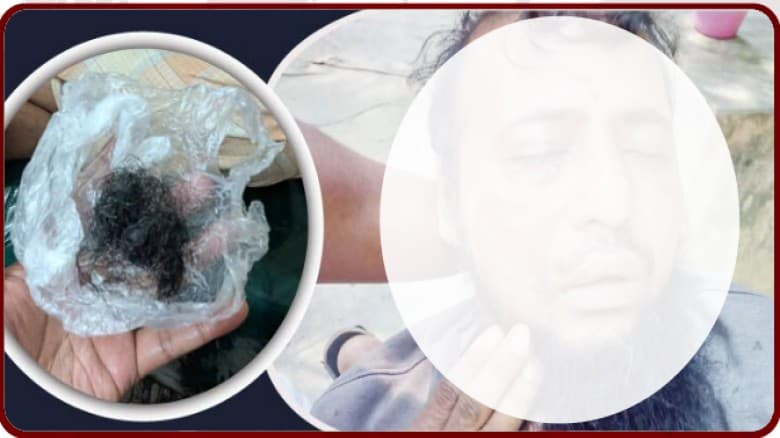 জামায়াত কর্মীকে মারধর ও দাড়ি উপড়ে ফেলা