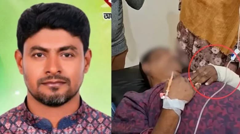 প্রধান শিক্ষককে মেরে হাত ভাঙার অভিযোগে  যুবদল সভাপতি বহিষ্কার