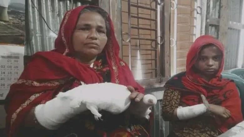 বরগুনার আমতলীতে তালাক দেওয়া স্ত্রীর বাড়িতে গিয়ে শাশুড়ি ও শ্যালকের স্ত্রীকে কুপিয়ে জখম