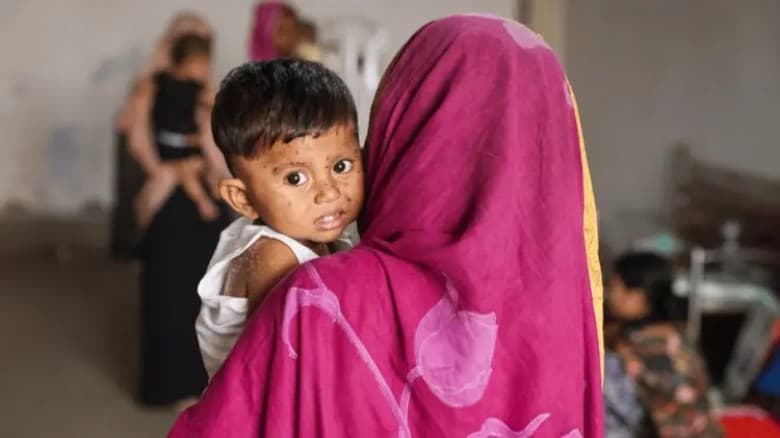 হামের উপসর্গে একদিনে ১২ শিশুর মৃত্যু, আক্রান্ত ৯৭৪