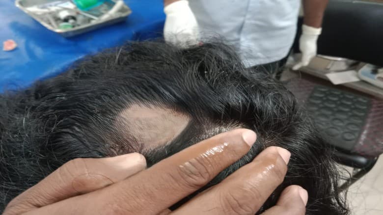 "শিবির ট্যাগ"দিয়ে সাধারণ শিক্ষার্থীর উপর হামলা করলো ছাত্রদল নেতা